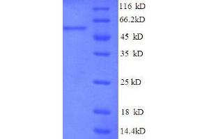 TNF Receptor-Associated Protein 1 (TRAP1) (AA 60-308), (partial) protein (GST tag)