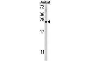 Western blot analysis of TPT1 Antibody (Center) in Jurkat cell line lysates (35ug/lane). (TPT1 anticorps  (Middle Region))