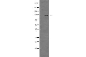 Western blot analysis of E2F7 expression in SP2/0 cell lysate ,The lane on the left is treated with the antigen-specific peptide.