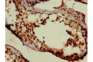 Immunohistochemistry of paraffin-embedded human testis tissue using ABIN7169952 at dilution of 1:100
