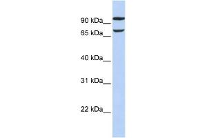 WB Suggested Anti-FAM38B Antibody Titration:  0. (PIEZO2 anticorps  (Middle Region))