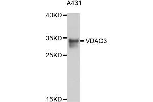 Western blot analysis of extracts of A-431 cells, using VDAC3 antibody (ABIN4905588) at 1:1000 dilution.