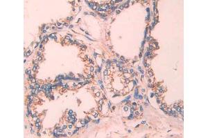IHC-P analysis of Kidney tissue, with DAB staining. (TCN2 anticorps  (AA 19-427))