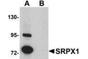 Western Blotting (WB) image for anti-Sushi-Repeat Containing Protein, X-Linked (SRPX) (N-Term) antibody (ABIN2476576) (SRPX anticorps  (N-Term))