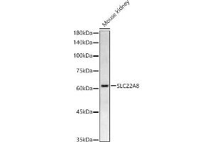 Western blot analysis of extracts of Mouse kidney, using SLC22 Rabbit pAb antibody (ABIN7270419) at 1:500 dilution.