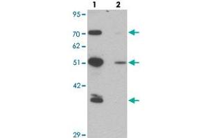 Western blot analysis of TMPO in HeLa cell lysate with TMPO polyclonal antibody  at 0.