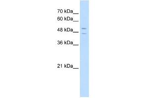 STEAP3 antibody used at 5 ug/ml to detect target protein. (STEAP3 anticorps  (N-Term))