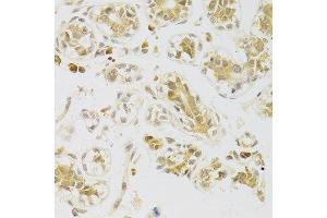 Immunohistochemistry of paraffin-embedded human breast using CASP2 Antibody. (Caspase 2 anticorps  (AA 153-452))