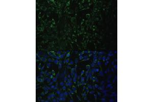 Immunofluorescence analysis of NIH-3T3 cells using  antibody (ABIN6131426, ABIN6136765, ABIN6136766 and ABIN6223405) at dilution of 1:100.