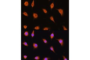 Immunofluorescence analysis of L929 cells using alpha Sarcoglycan (alpha Sarcoglycan (SGCA)) Rabbit pAb (ABIN1682687, ABIN5664644, ABIN5664646 and ABIN6220497) at dilution of 1:100. (SGCA anticorps  (AA 60-290))