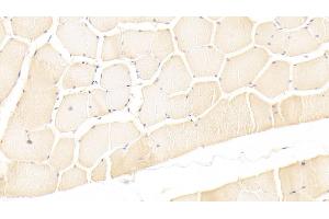 Detection of LIF in Human Skeletal muscle Tissue using Monoclonal Antibody to Leukemia Inhibitory Factor (LIF)
