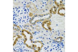 Immunohistochemistry of paraffin-embedded mouse kidney using POLG2 antibody (ABIN5974040) at dilution of 1/100 (40x lens). (POLG2 anticorps)