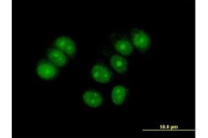 Immunofluorescence of purified MaxPab antibody to ZNF554 on MCF-7 cell. (ZNF554 anticorps  (AA 1-538))