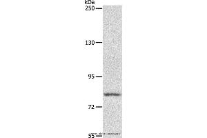 Western blot analysis of Mouse liver tissue, using ABCB6 Polyclonal Antibody at dilution of 1:250 (ABCB6 anticorps)