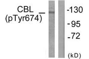 Western blot analysis of extracts from HepG2 cells treated with Na2VO3 0. (CBL anticorps  (pTyr674))