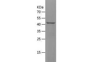 Western Blotting (WB) image for Carbohydrate (N-Acetylgalactosamine 4-Sulfate 6-O) Sulfotransferase 15 (CHST15) (AA 330-561) protein (His-IF2DI Tag) (ABIN7122125)