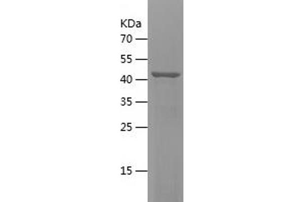CHST15 Protein (AA 330-561) (His-IF2DI Tag)
