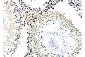 ABIN6261240 and ABIN6266855 at 1/100 staining Rat testis tissue by IHC-P. (DCP1A anticorps  (Internal Region))