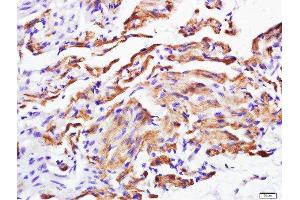 Paraformaldehyde-fixed, paraffin embedded rat heart, Antigen retrieval by boiling in sodium citrate buffer (pH6) for 15min, Block endogenous peroxidase by 3% hydrogen peroxide for 30 minutes, Blocking buffer (normal goat serum) at 37°C for 20min, Antibody incubation with Calponin 2 + 3 Polyclonal Antibody, Unconjugated  at 1:500 overnight at 4°C, followed by a conjugated secondary and DAB staining