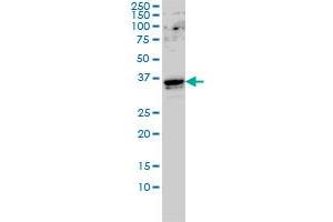 GTF2E2 monoclonal antibody (M01A), clone 2C3 Western Blot analysis of GTF2E2 expression in Hela S3 NE . (GTF2E2 anticorps  (AA 1-291))