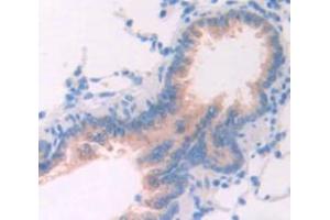 IHC-P analysis of Rat Tissue, with DAB staining. (TPSAB1 anticorps  (AA 29-148))