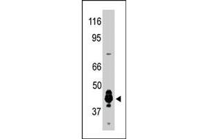 The PRMT6 polyclonal antibody  was used to detect human PRMT6 protein in human brain extract in a Western blot analysis.