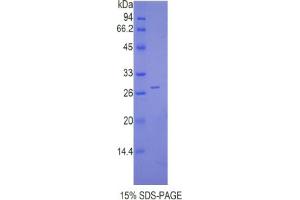 SDS-PAGE analysis of Mouse Cathepsin C Protein. (CTSC Protéine)