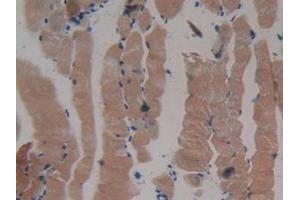 IHC-P analysis of Mouse Skeletal Muscle Tissue, with DAB staining. (MYH2 anticorps  (AA 1238-1472))