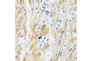 Immunohistochemistry of paraffin-embedded mouse heart using PHPT1 antibody (ABIN3021488, ABIN3021489, ABIN3021490 and ABIN6215139) at dilution of 1:100 (40x lens). (PHPT1 anticorps  (AA 1-125))