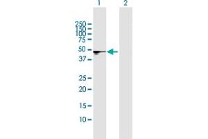 Western Blot analysis of SMPDL3B expression in transfected 293T cell line by SMPDL3B MaxPab polyclonal antibody. (SMPDL3B anticorps  (AA 1-373))
