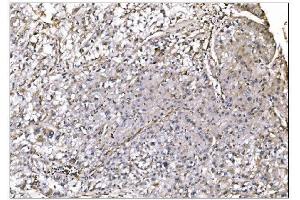 IHC analysis of NDEL1 using anti-NDEL1 antibody (ABIN7602511). (NDEL1 anticorps  (AA 80-320))
