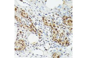 Immunohistochemistry of paraffin-embedded rat ovary using MT2A Rabbit pAb (ABIN3015841, ABIN3015842, ABIN3015843 and ABIN6219186) at dilution of 1:150 (40x lens).