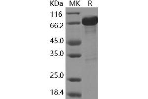 Western Blotting (WB) image for Glutamate Decarboxylase 2 (Pancreatic Islets and Brain, 65kDa) (GAD2) protein (GST tag) (ABIN7317017)