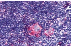 Immunohistochemical (Formalin/PFA-fixed paraffin-embedded sections) staining in human thymus with P2RY5 polyclonal antibody . (LPAR6 anticorps  (2nd Extracellular Domain))