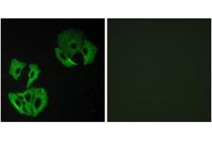 Immunofluorescence analysis of A549 cells, using MADD Antibody. (MADD anticorps  (AA 751-800))