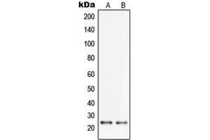 Western blot analysis of PGRMC2 expression in HL60 (A), HeLa (B) whole cell lysates. (PGRMC2 anticorps  (C-Term))