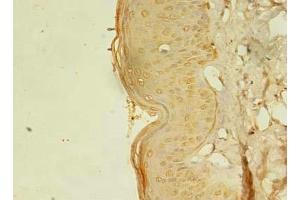 Immunohistochemistry of paraffin-embedded human skin tissue using ABIN7168075 at dilution of 1:100