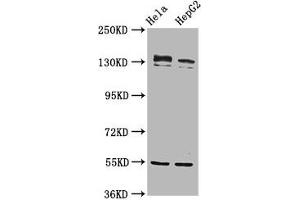 Western Blot Positive WB detected in: Hela whole cell lysate, HepG2 whole cell lysate All lanes: RECQL4 antibody at 4. (RECQL4 anticorps  (AA 200-337))