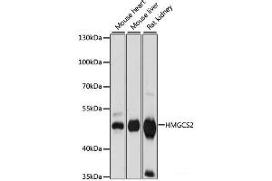 Western blot analysis of extracts of various cell lines using HMGCS2 Polyclonal Antibody at dilution of 1:1000. (HMGCS2 anticorps)