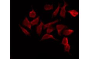 ABIN6272420 staining K562 by IF/ICC.