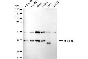 Western blotting analysis using MRPS35 antibody (ABIN7799437).