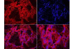 Formalin-fixed and paraffin embedded human placenta labeled with Rabbit Anti-TLR7 Polyclonal Antibody, Unconjugated  DAPI staining (TLR7 anticorps  (AA 461-560))