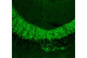 Indirect immunolabeling of PFA fixed section of mouse hippocampus (dilution 1 : 500). (Slc30a3 anticorps  (AA 2-75))