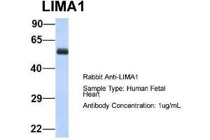Host:  Rabbit  Target Name:  LIMA1  Sample Type:  Human Fetal Heart  Antibody Dilution:  1. (LIMA1 anticorps  (N-Term))