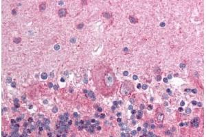 Human Brain, Cerebellum (formalin-fixed, paraffin-embedded) stained with NCOR1 antibody ABIN214125 at 5 ug/ml followed by biotinylated goat anti-rabbit IgG secondary antibody ABIN481713, alkaline phosphatase-streptavidin and chromogen.