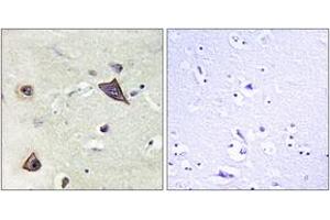 Immunohistochemistry analysis of paraffin-embedded human brain tissue, using NMDAR1 (Ab-896) Antibody. (GRIN1/NMDAR1 anticorps  (AA 862-911))