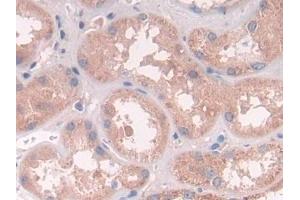 Detection of ATP6AP2 in Human Kidney Tissue using Polyclonal Antibody to ATPase, H+ Transporting, Lysosomal Accessory Protein 2 (ATP6AP2)