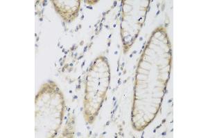 Immunohistochemistry of paraffin-embedded human stomach using NB antibody (ABIN6132989, ABIN6144383, ABIN6144385 and ABIN6223030) at dilution of 1:200 (40x lens). (NAT8B anticorps  (AA 75-165))