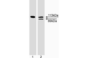 Western blot analysis of PARP cleavage. (PARP1 anticorps)