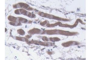 Detection of PLIN1 in Mouse Skin Tissue using Polyclonal Antibody to Perilipin 1 (PLIN1)